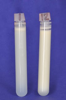 leite anterior e posterior 2